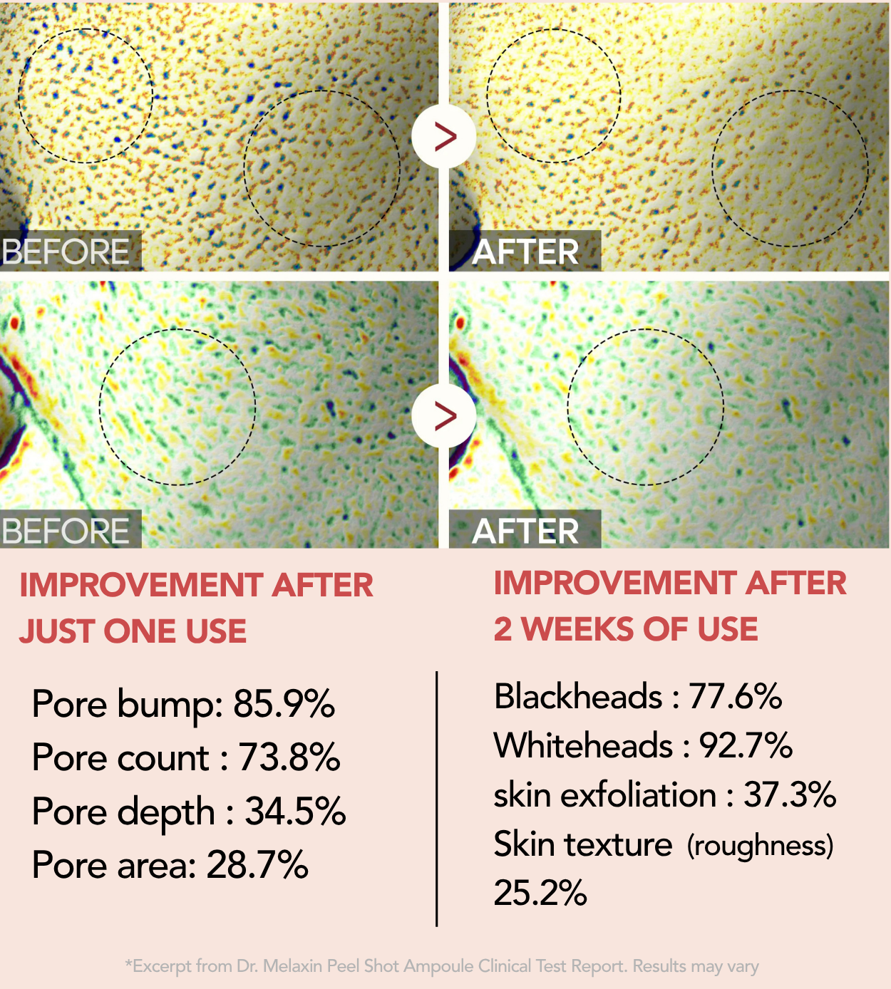 Dr. Glorix Peel Shot Glow Rice Line