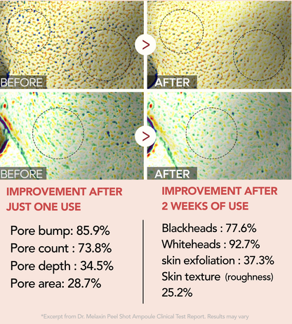 Dr. Glorix Peel Shot Glow Rice Line